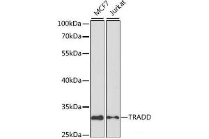 Western blot analysis of extracts of various cell lines using TRADD Polyclonal Antibody at dilution of 1:1000. (TRADD anticorps)