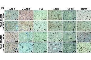 BMP4 down-regulates the mTORC1 signaling pathway in mouse liver.