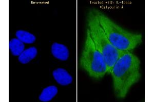 Immunofluorescent analysis of 4 % paraformaldehyde-fixed, 0. (TR4 anticorps  (pSer439))