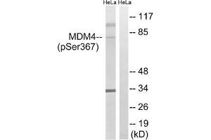 Western blot analysis of extracts from HeLa cells, treated with calyculinA (50 ng/mL, 30 mins), using MDM4 (Phospho-Ser367) antibody. (MDM4-binding Protein anticorps  (pSer367))