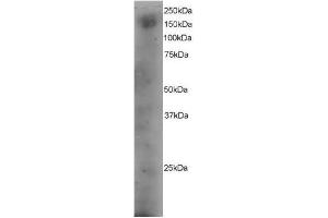 Image no. 1 for anti-Dedicator of Cytokinesis 1 (DOCK1) (C-Term) antibody (ABIN374114) (DOCK1 anticorps  (C-Term))