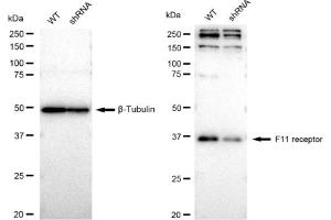 Western blotting analysis using F11 receptor antibody (ABIN7798557). (Recombinant F11R anticorps)