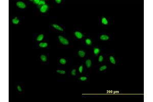 Immunofluorescence of purified MaxPab antibody to PHF10 on HeLa cell. (PHF10 anticorps  (AA 1-410))