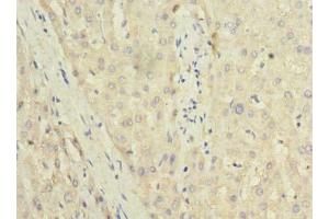 Immunohistochemistry of paraffin-embedded human liver tissue using ABIN7173508 at dilution of 1:100 (TRIT1 anticorps  (AA 1-324))