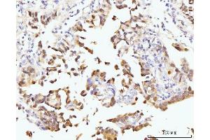 IHC analysis of Nucleostemin/GNL3 using anti-Nucleostemin/GNL3 antibody (ABIN7601778).