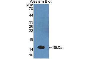 Western Blotting (WB) image for anti-Neurofilament, Light Polypeptide (NEFL) (AA 281-396) antibody (ABIN1176228) (NEFL anticorps  (AA 281-396))