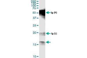 anti-Polymerase (RNA) I Polypeptide D, 16kDa (POLR1D) (AA 1-133) antibody
