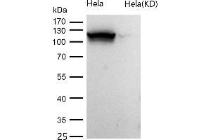 All lanes use the Antibody at 1:1K dilution for 1 hour at room temperature.