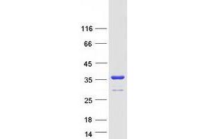 Validation with Western Blot