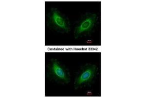 ICC/IF Image Immunofluorescence analysis of methanol-fixed HeLa, using Calmodulin 2, antibody at 1:500 dilution. (Calmodulin 2 anticorps)