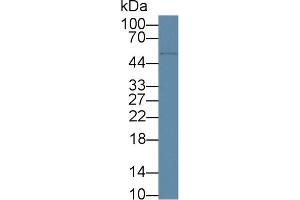 Detection of CD5 in Human A549 cell lysate using Polyclonal Antibody to Cluster Of Differentiation 5 (CD5)
