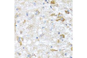 Immunohistochemistry of paraffin-embedded rat brain using ABCB8 antibody.