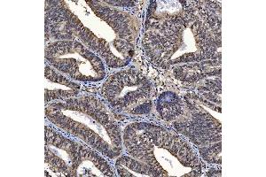 IHC analysis of SAP130 using anti-SAP130 antibody (ABIN7601247). (SAP130 anticorps  (AA 309-913))