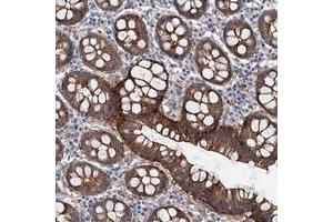 Immunohistochemical staining of human colon with TMTC3 polyclonal antibody  shows strong cytoplasmic and membranous positivity in glandular cells.