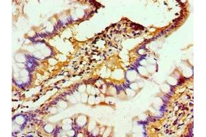 Immunohistochemistry of paraffin-embedded human small intestine tissue using ABIN7150218 at dilution of 1:100 (ALKBH2 anticorps  (AA 1-261))
