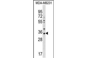 Western blot analysis in MDA-MB231 cell line lysates (35ug/lane).