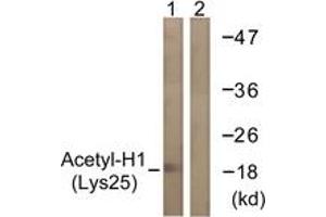 Western blot analysis of extracts from COS7 cells, treated with TSA 400nM 24h, using Histone H1 (Acetyl-Lys25) Antibody. (Histone H1 anticorps  (acLys25))