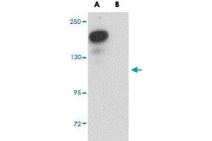 Western blot analysis of PLEKHM2 in rat brain tissue lysate with PLEKHM2 polyclonal antibody  at 0. (PLEKHM2 anticorps  (C-Term))