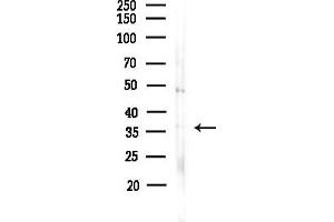 anti-Retinaldehyde Binding Protein 1 (RLBP1) (Internal Region) antibody