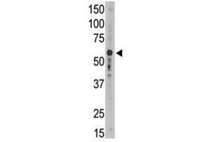 Image no. 2 for anti-Sialic Acid Binding Ig-Like Lectin 9 (SIGLEC9) (C-Term) antibody (ABIN357151) (SIGLEC9 anticorps  (C-Term))