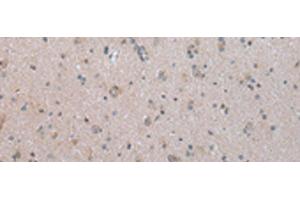 Immunohistochemistry of paraffin-embedded Human brain tissue using COX17 Polyclonal Antibody at dilution of 1:45(x200) (COX17 anticorps)