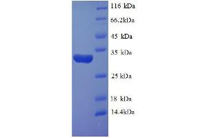 SDS-PAGE (SDS) image for Hypoxia Inducible Factor 1, alpha Subunit (Basic Helix-Loop-Helix Transcription Factor) (HIF1A) (AA 579-826), (partial) protein (His tag) (ABIN1047191)