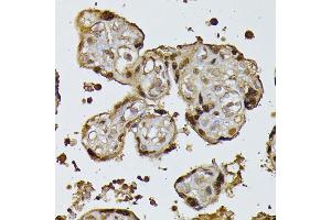 Immunohistochemistry of paraffin-embedded human placenta using RPS27A antibody (ABIN7270022) at dilution of 1:100 (40x lens).