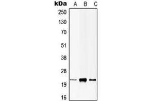 Western blot analysis of CIB1 expression in HEK293T (A), H9C2 (B), rat brain (C) whole cell lysates. (CIB1 anticorps  (Center))