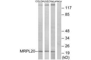 Western blot analysis of extracts from COLO cells, HUVEC cells and HeLa cells, using MRPL20 antibody. (MRPL2 anticorps  (C-Term))