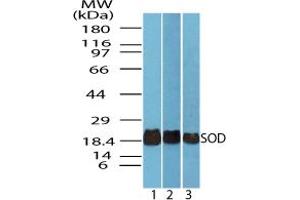Image no. 1 for anti-Superoxide Dismutase antibody (ABIN1496240) (Superoxide Dismutase anticorps)
