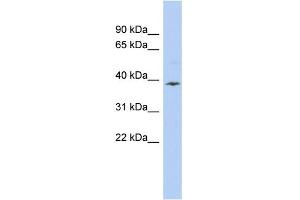 WB Suggested Anti-APOL6 Antibody Titration:  0. (APOL6 anticorps  (Middle Region))