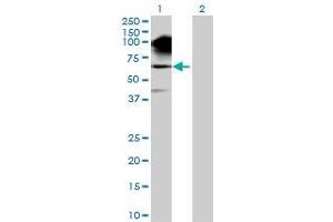 Lane 1: SNCAIP transfected lysate ( 66.