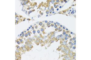 Immunohistochemistry of paraffin-embedded mouse testis using POLG2 antibody (ABIN5974040) at dilution of 1/100 (40x lens). (POLG2 anticorps)