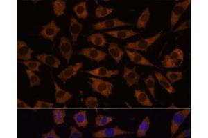 Immunofluorescence analysis of L929 cells using EIF5B Polyclonal Antibody at dilution of 1:100.