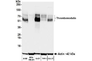 Western Blotting (WB) image for anti-Thrombomodulin (THBD) (AA 17-515) antibody (ABIN7795643)