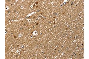 The image on the left is immunohistochemistry of paraffin-embedded Human brain tissue using ABIN7131518(TWF1 Antibody) at dilution 1/30, on the right is treated with fusion protein. (TWF1 anticorps)