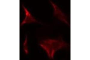 ABIN6275272 staining HeLa by IF/ICC. (NDUFA9 anticorps  (Internal Region))
