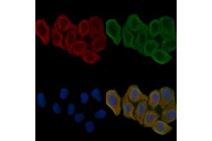 ABIN6262097 and ABIN6266556 staining Hela cells(24h of starvation treatment) by IF/ICC. (HSPA9 anticorps  (C-Term))