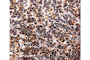 Immunohistochemistry of Human tonsil using IL10RA Polyclonal Antibody at dilution of 1:30 (IL-10RA anticorps)
