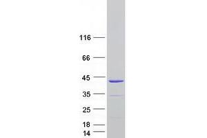 Validation with Western Blot
