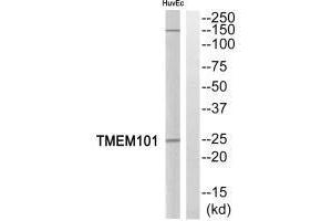 Western blot analysis of extracts from HuvEc cells, using TMEM101 antibody. (TMEM11 anticorps)