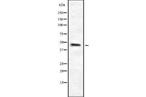 Western blot analysis of HPD using K562 whole cell lysates (HPD anticorps  (C-Term))