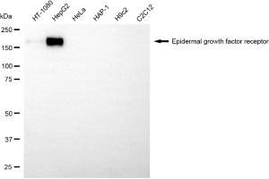 Western blotting analysis using epidermal growth factor receptor antibody (ABIN7798474). (EGFR anticorps)