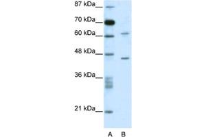 Western Blotting (WB) image for anti-TRM1 tRNA Methyltransferase 1-Like (TRMT1L) antibody (ABIN2460173) (TRMT1L anticorps)