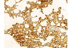 anti-GTP Cyclohydrolase I Feedback Regulator (GCHFR) (Internal Region) antibody