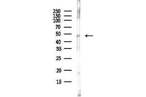 anti-Muscarinic Acetylcholine Receptor M1 (CHRM1) (C-Term) antibody
