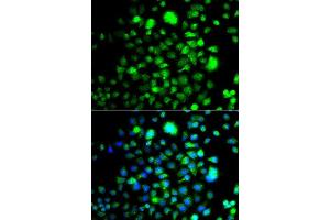 Immunofluorescence analysis of A549 cells using PEX14 antibody.