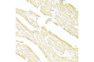 Immunohistochemistry of paraffin-embedded rat heart using UQCC2 antibody  at dilution of 1:100 (40x lens). (MNF1 anticorps  (AA 14-126))