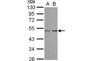 Western Blotting (WB) image for anti-SET Domain Containing (Lysine Methyltransferase) 7 (SETD7) (AA 1-203) antibody (ABIN1500902) (SETD7 anticorps  (AA 1-203))