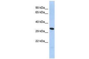 Image no. 1 for anti-Forkhead Box K2 (FOXK2) (AA 276-303) antibody (ABIN6742939) (Forkhead Box K2 anticorps  (AA 276-303))